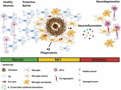 Microglial Immunometabolism in Alzheimer’s Disease